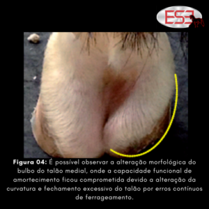 Figura 04: É possível observar a alteração morfológica do bulbo do talão medial, onde a capacidade funcional de amortecimento ficou comprometida devido a alteração da curvatura e fechamento excessivo do talão por erros contínuos de ferrageamento.